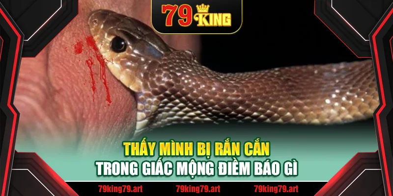 Thấy mình bị rắn cắn trong giấc mộng điềm báo gì
